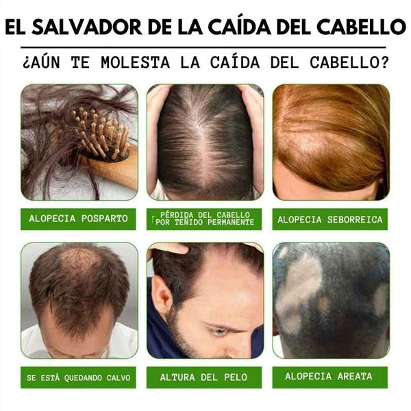 Tónico Renueva Cabello